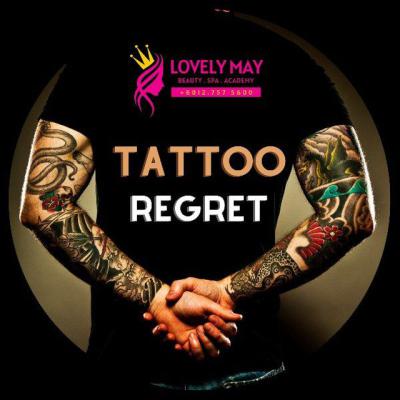 Tattoo Removal